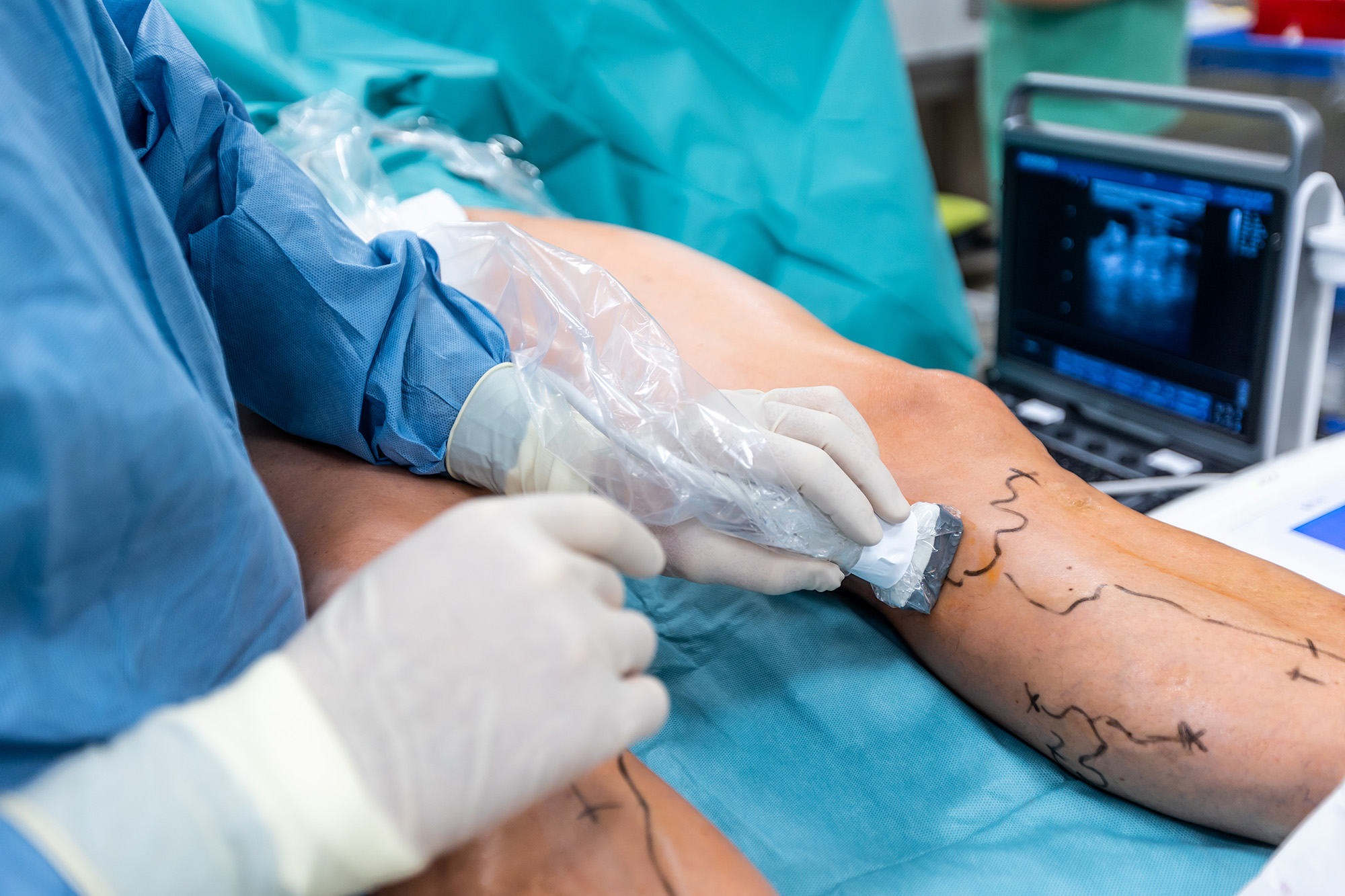 Chirurgie vasculara_3