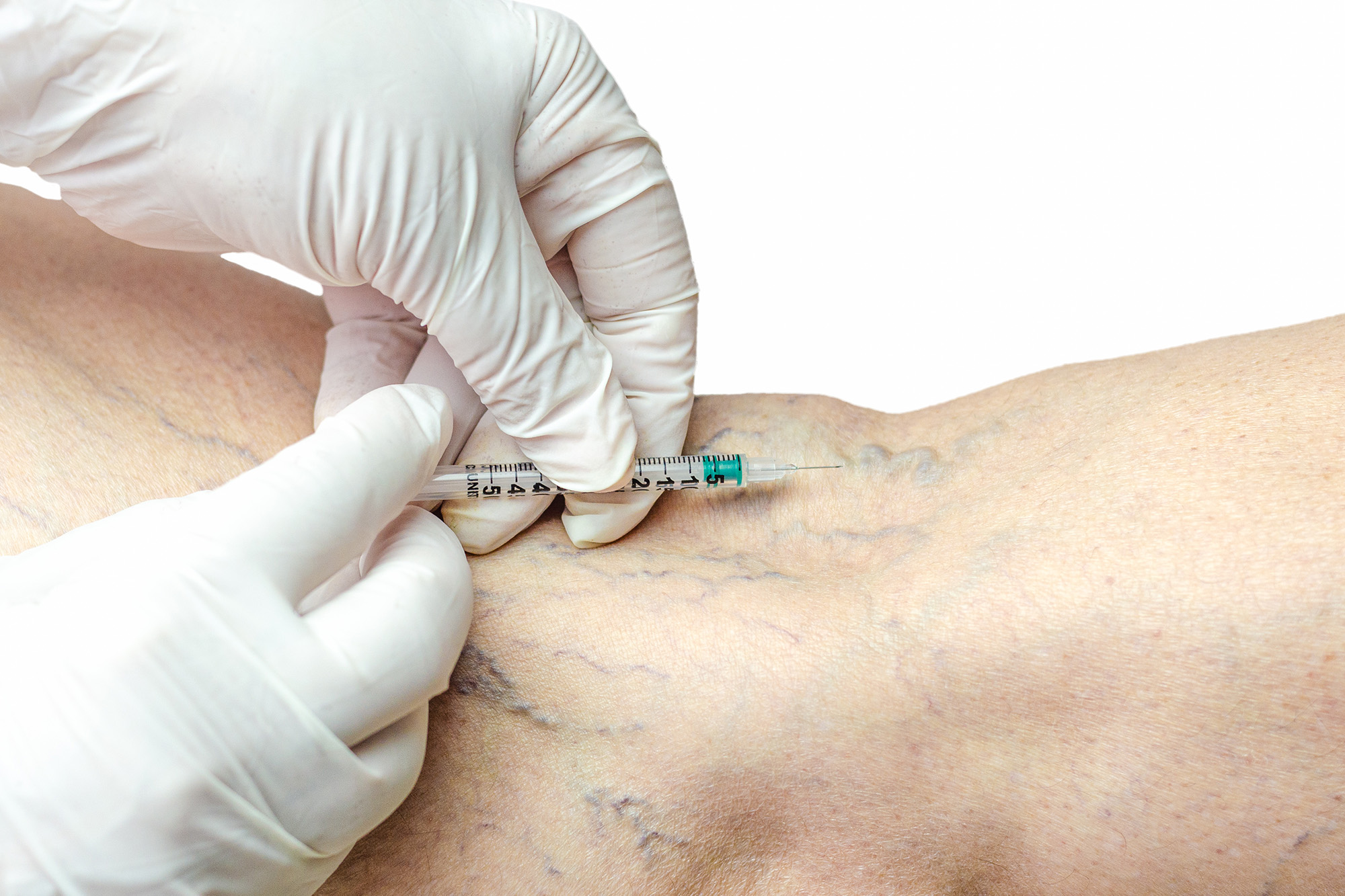 Chirurgie vasculara_6